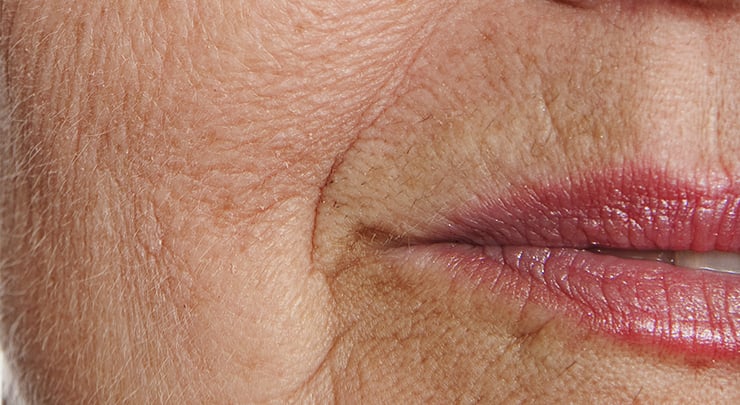 Close up of older woman's mouth and wrinkled skin.